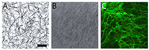 Laser scanning confocal microscopy images of clots constructed from adult fibrinogen (A), neonatal fibrinogen (B), or a mixture of the two (C). Scale bar= 20 μm.