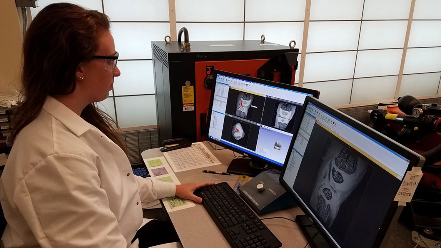 Stephanie Cone examines MRIs of pig knees.