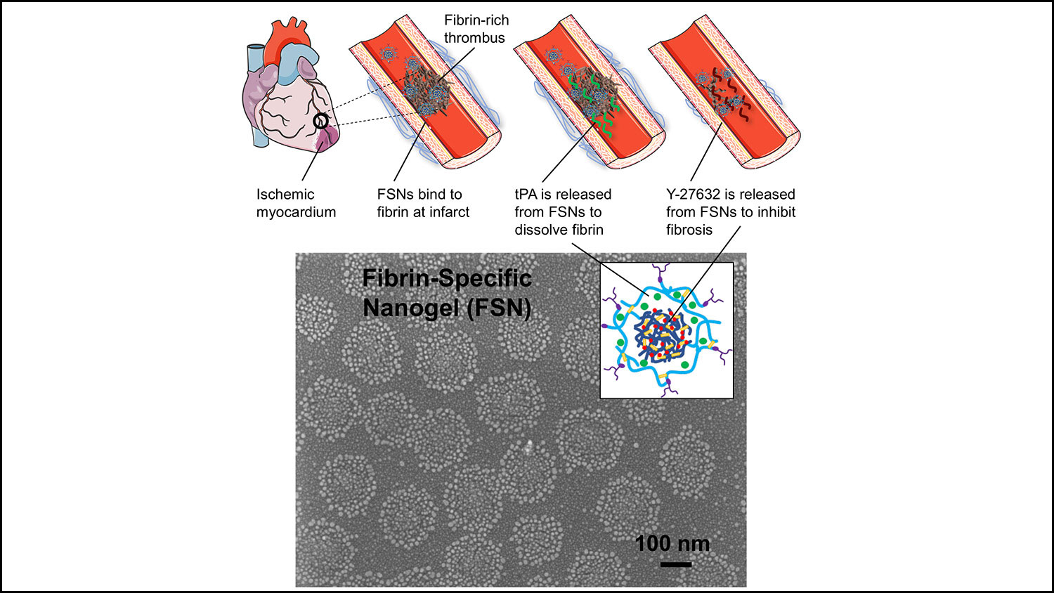 Graphic: Fibrin Specific Nanogel (FSN)