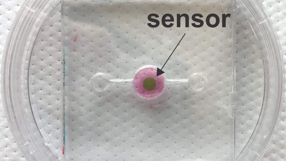 biosensor