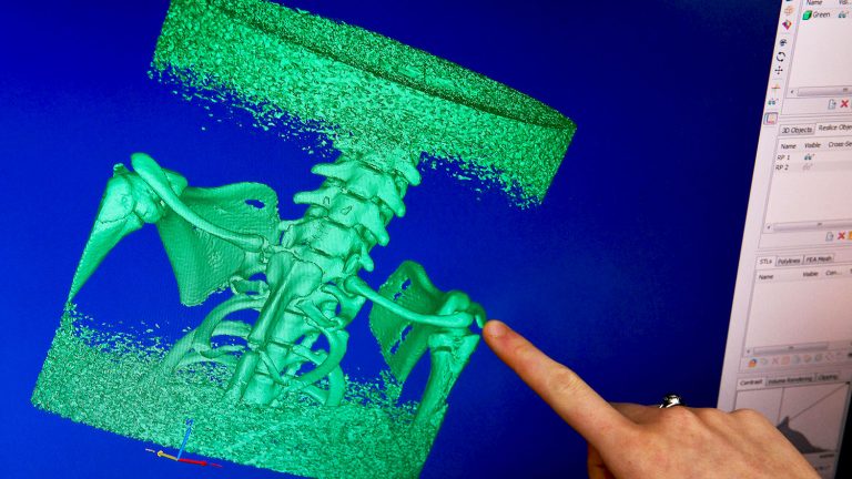 Graphic of spine displayed on computer screen