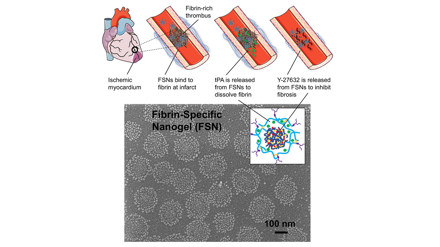 Fibrin-specific nanogel (FSN): FSNs bind to fibrin at infarct; tPA is released from FSNs to dissolve fibrin; Y-22632 is released from FSNs to inhibit fibrosis