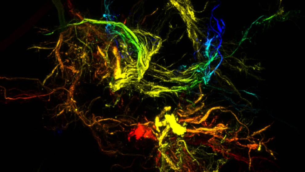Branched, sticky particles are the result of harnessing liquid chaos. Photo courtesy of Orlin Velev, NC State University.