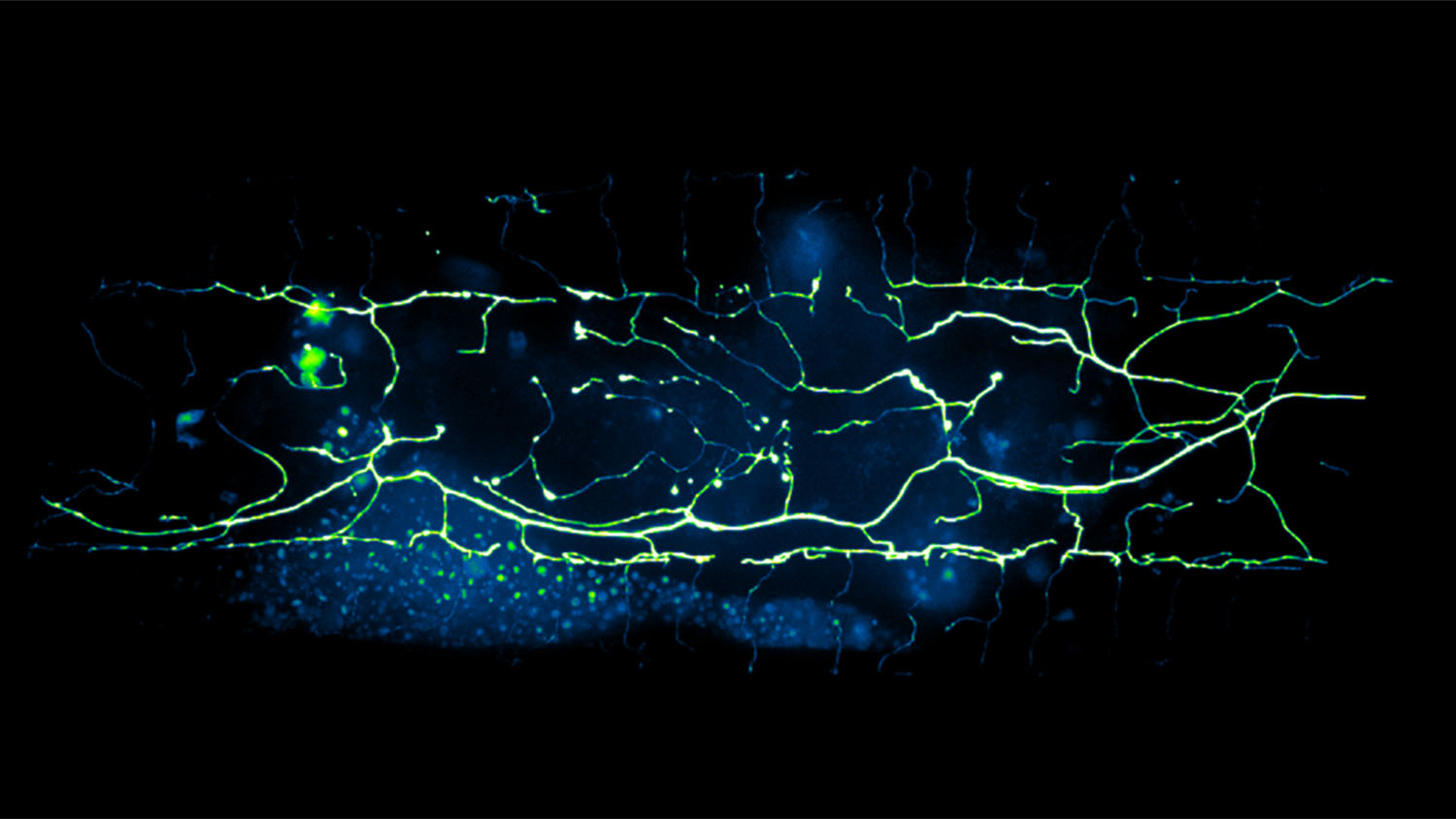 neon map of a neuron in C. elegans a