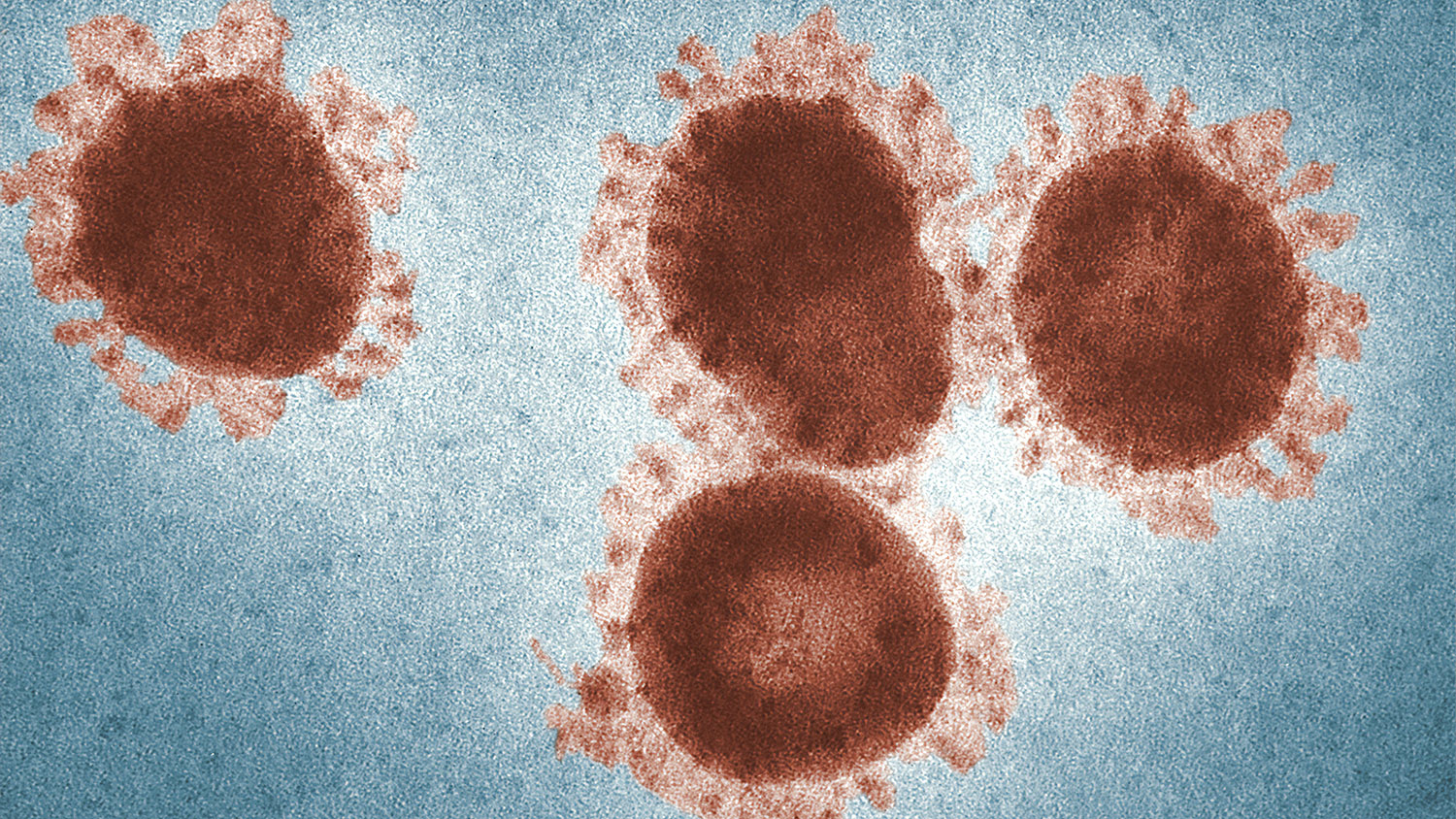 Four coronaviruses as viewed with an electron microscope