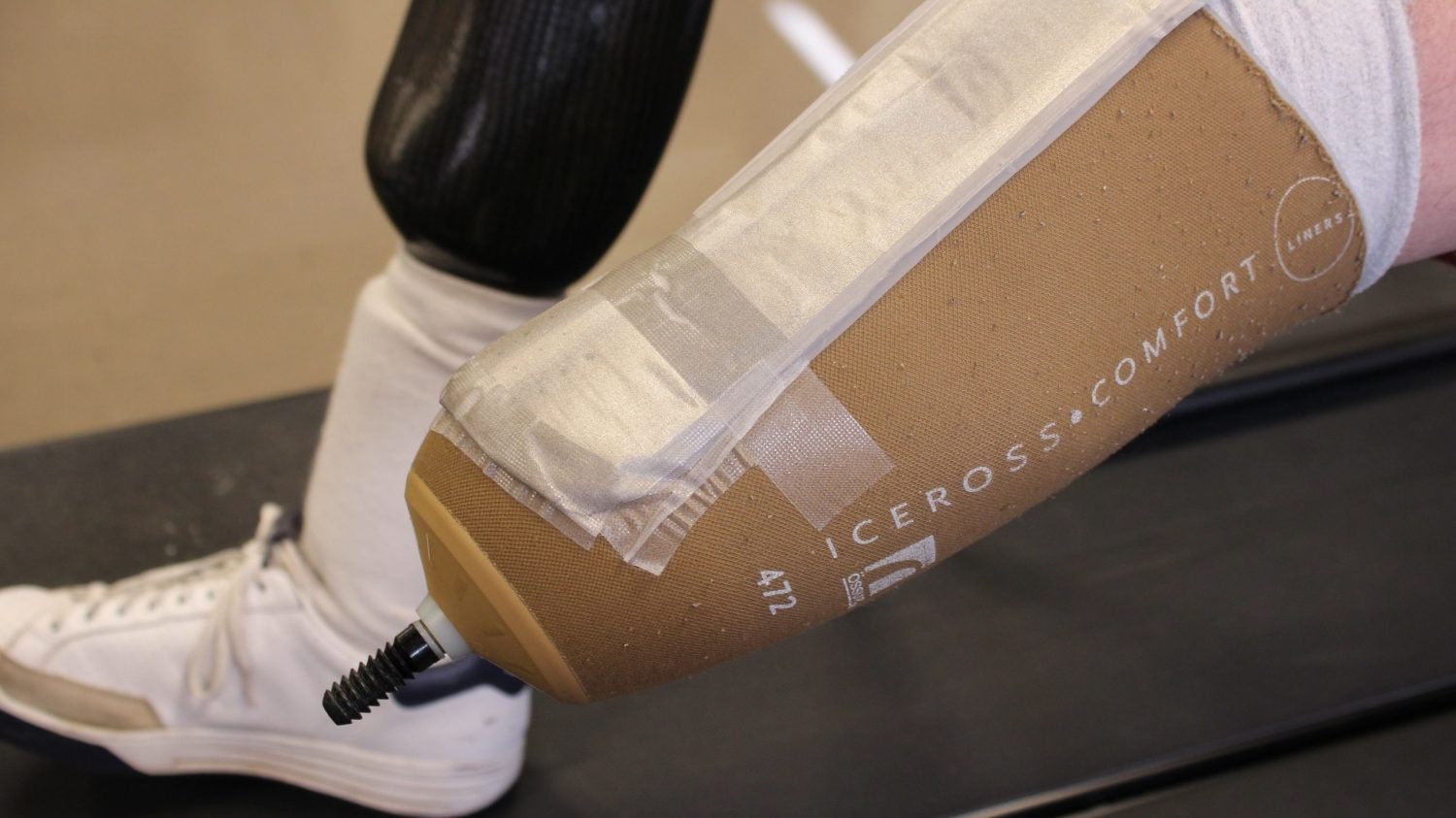 Textile sensor can detect pressure points on the socket of a prosthetic limb.